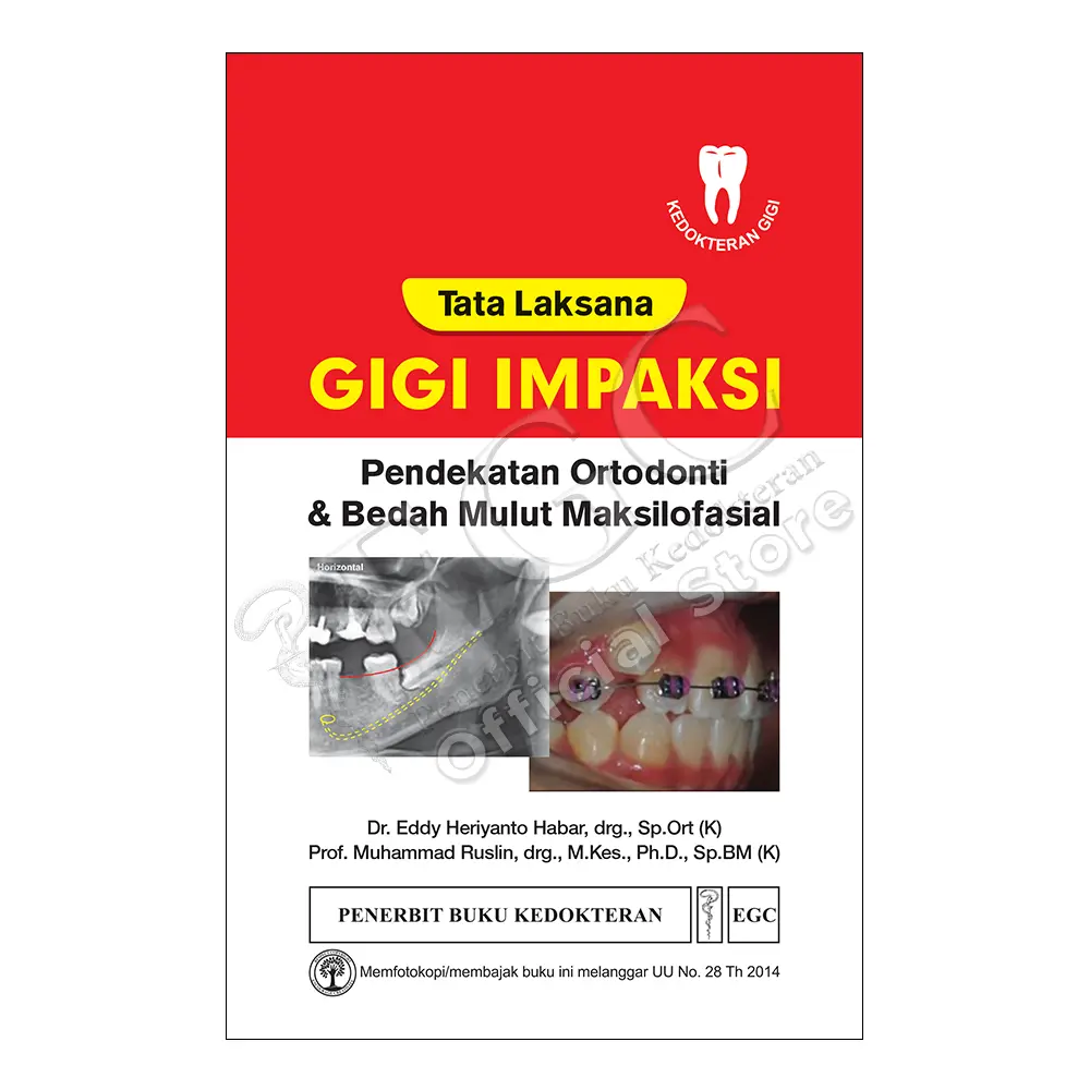 Tata Laksana Ked Gigi  Impaksi (bp)