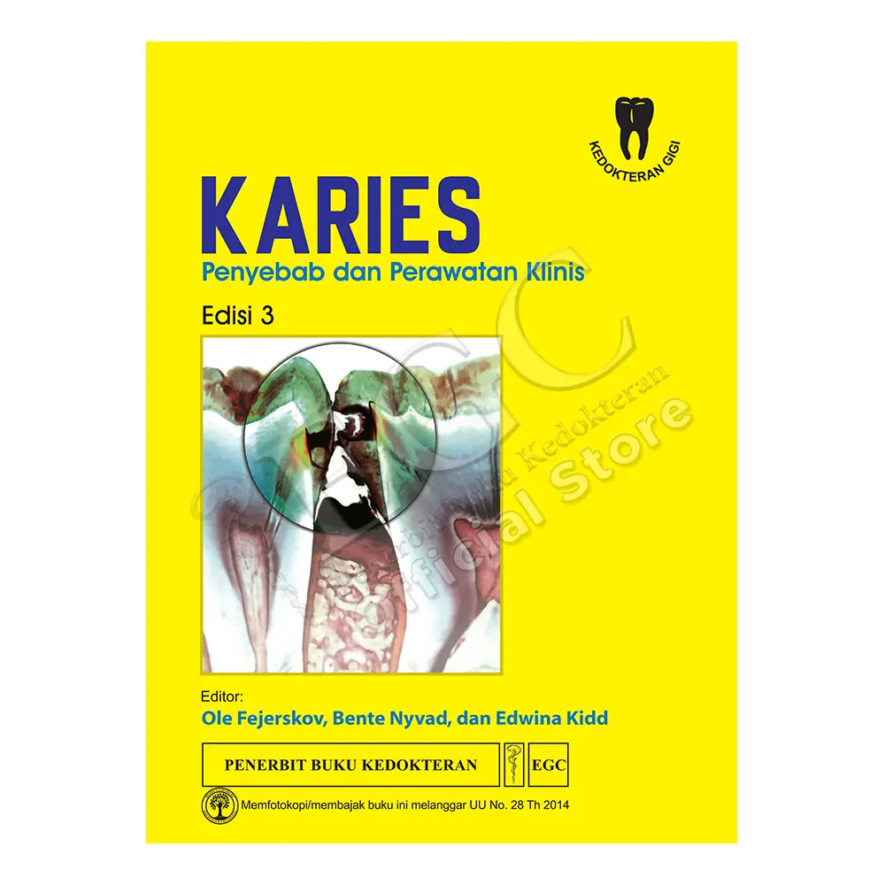Karies** Penyebab & Perawatan Klinis E/3 (bp)