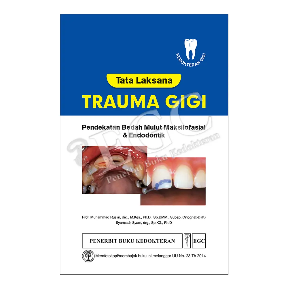 Tata Laksana Trauma Gigi
