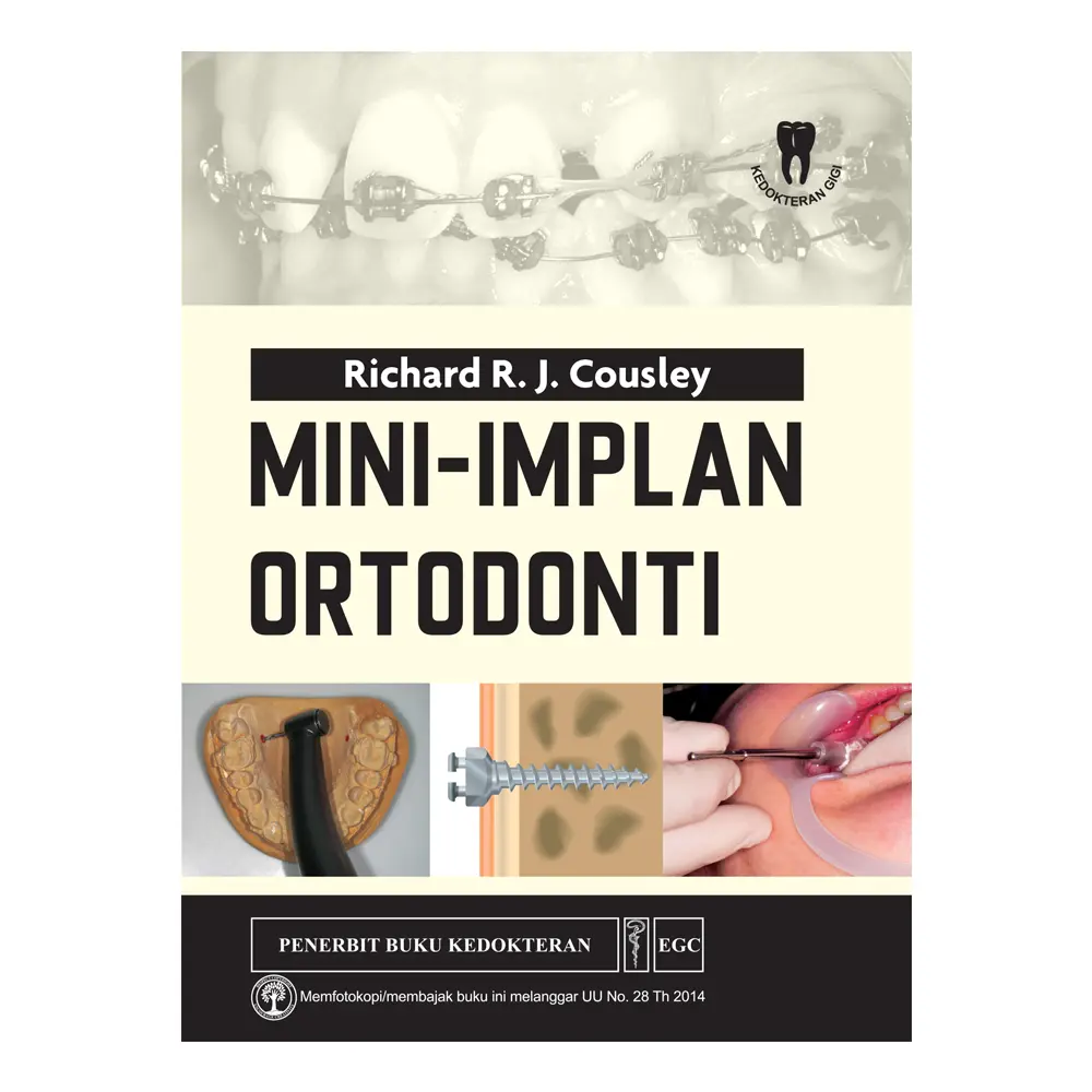 Mini-Implan Ortodonti (bp)