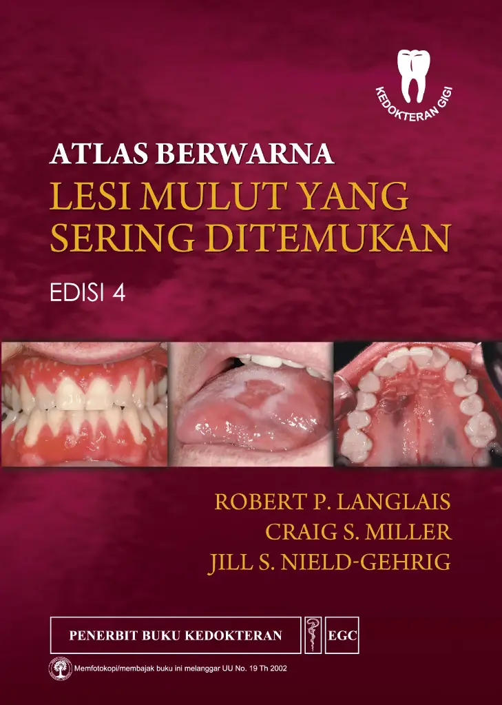 Atlas* Berwarna Lesi Mulut Yang Sering  E/4