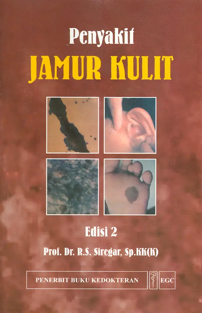 Penyakit* Jamur Kulit E/2