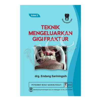 Teknik Mengeluarkan Gigi Fraktur E/2