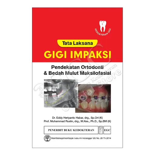 [978-623-203-440-2] Tata Laksana Ked Gigi  Impaksi (bp)