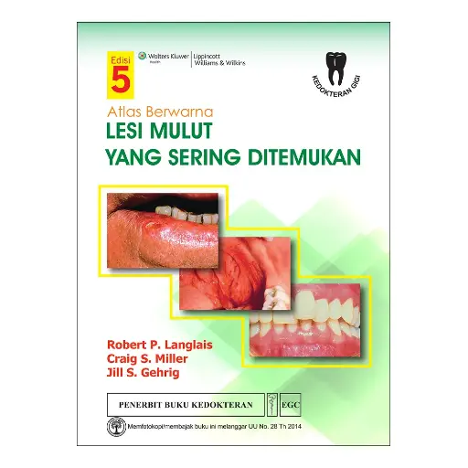 [978-623-203-231-6] Atlas* Berwarna Lesi Mulut E/5 (bp)