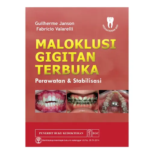 [978-979-044-835-3] Maloklusi* Gigitan Terbuka (bp)