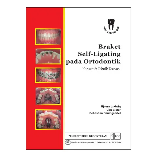 [978-979-044-647-2] Braket Self-Ligating pada Ortodontik (bp)
