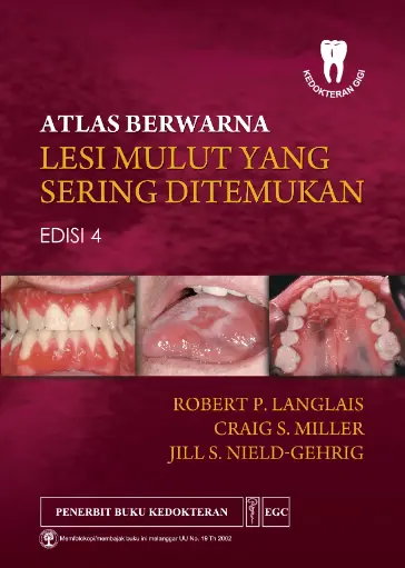 [978-979-044-459-1] Atlas* Berwarna Lesi Mulut Yang Sering  E/4